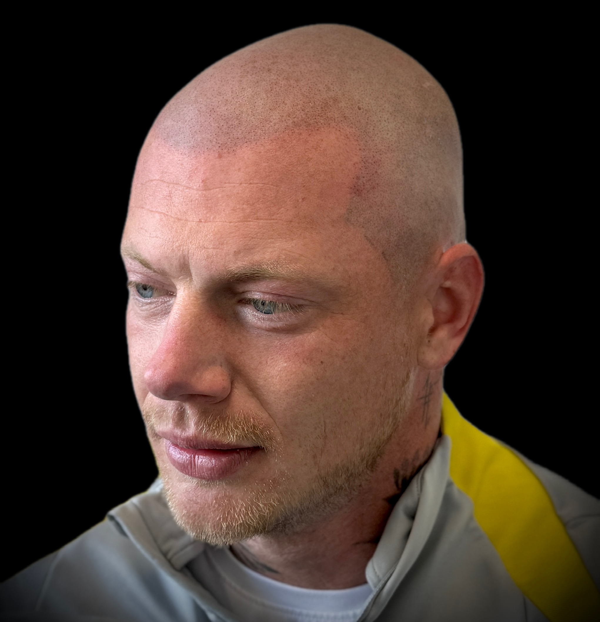 Natuurlijke micro haar pigmentatie met een zachte haarlijn