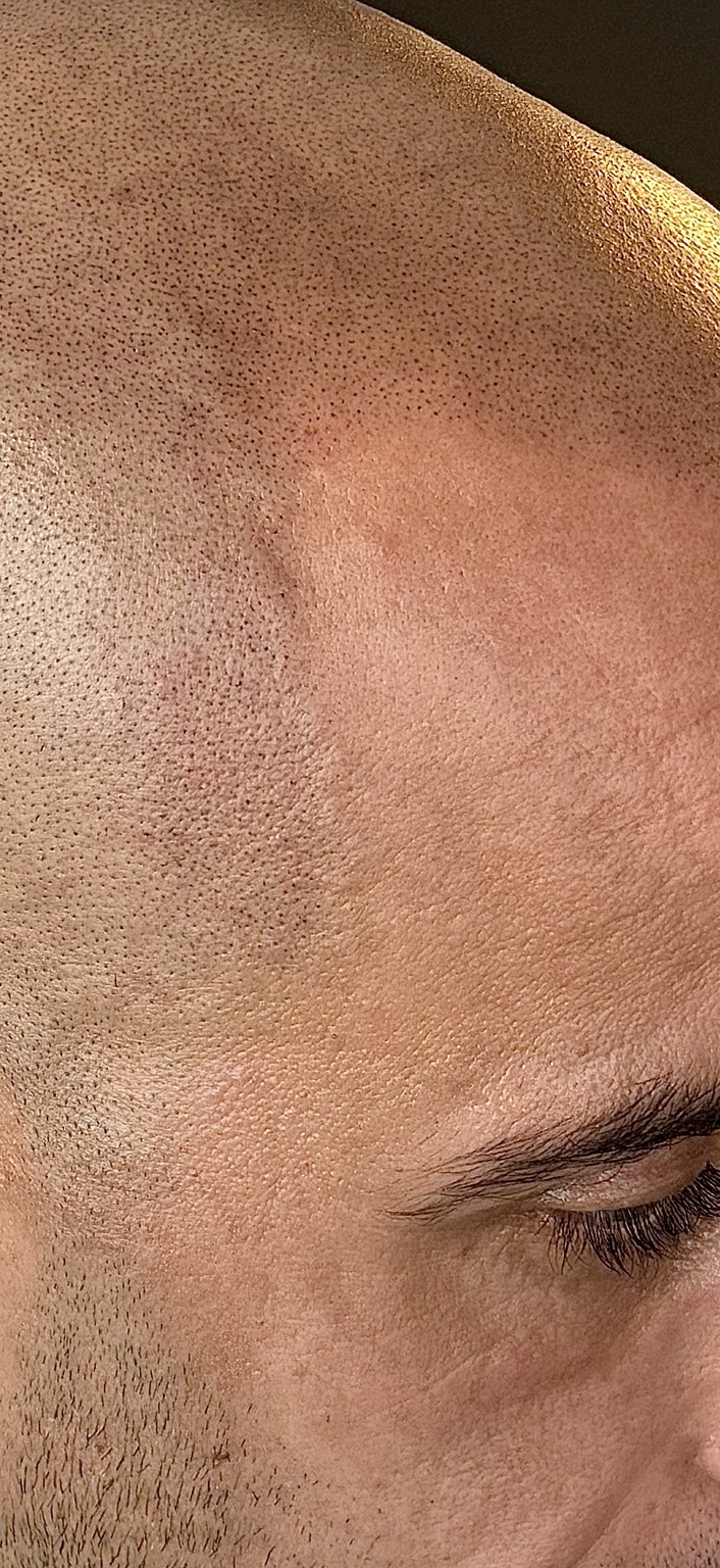 Detailfoto van natuurlijke pigmentdots op de hoofdhuid