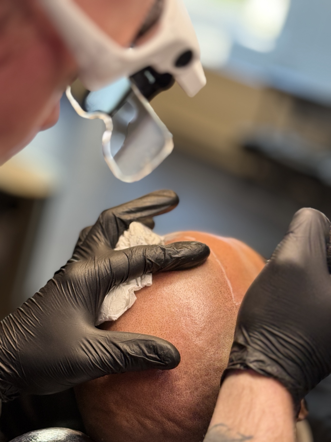Remco werkt geconcentreerd aan een micro haar pigmentatie